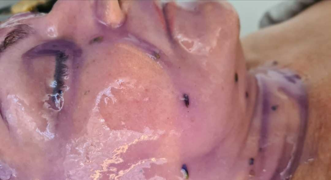 SunBox #beograd Masaža lica Soft Spa tretman lica i vrata - paket od 3 tretmana
