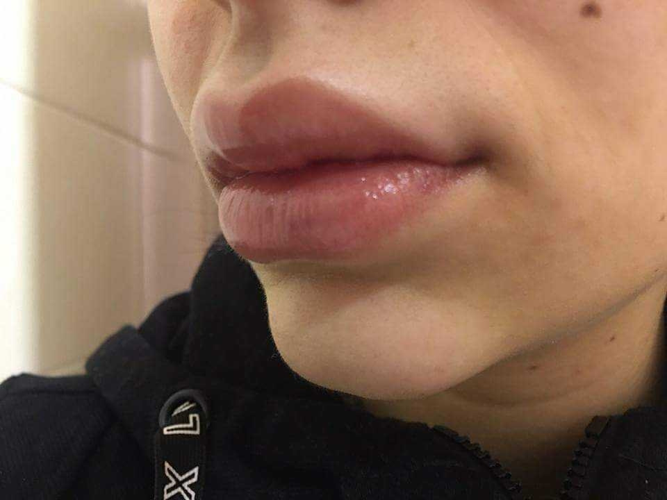 Womanizer #beograd Kozmetički doktori