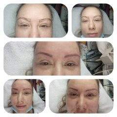 Derma Life #beograd Obrve