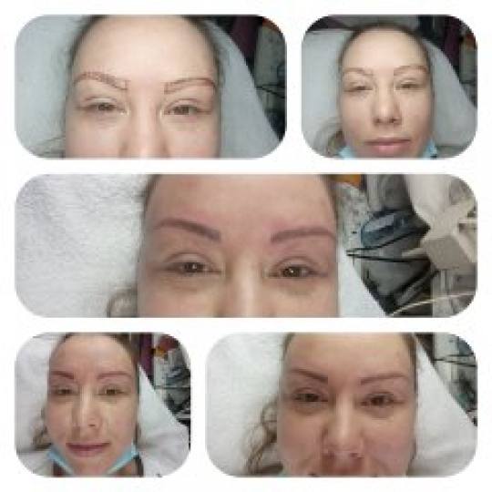 Derma Life #beograd Obrve Japansko iscrtavanje obrva