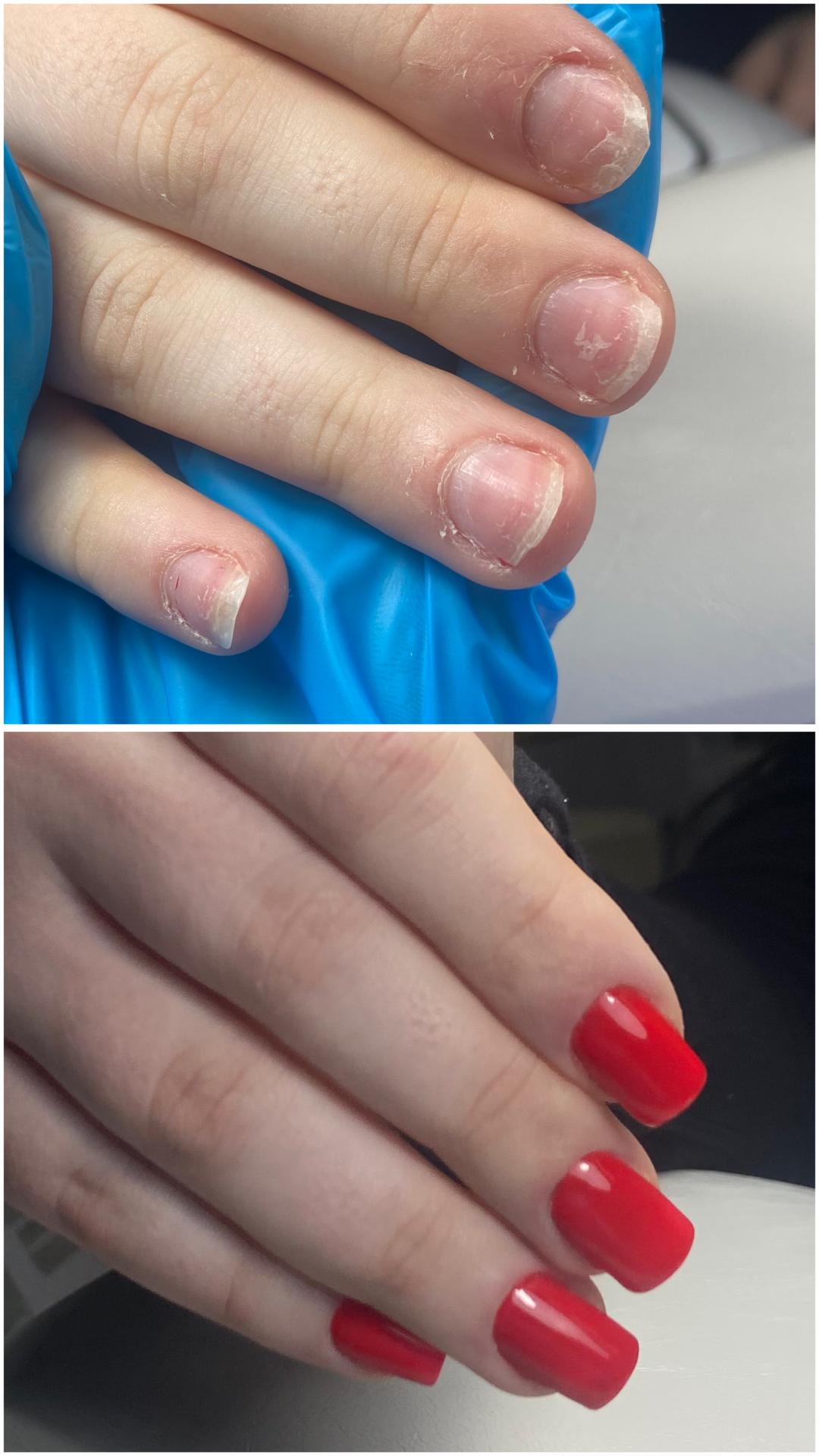 Nadogradnja noktiju gel - S dužina - majstor+ - Touch Aesthetic&Medical care, Beograd Manikir Nokti Manikir, Beograd, Vračar, Čubura, Crveni krst