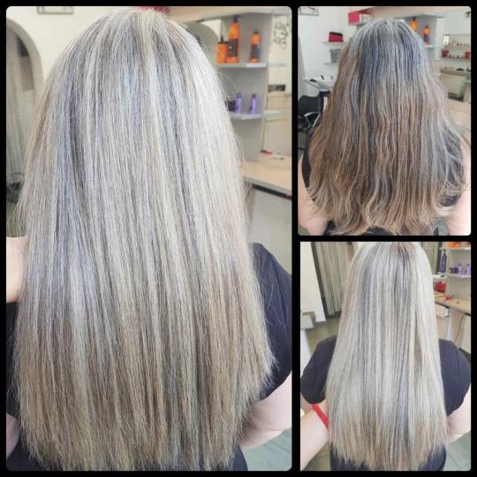 Topaz Beauty #beograd Botox kose