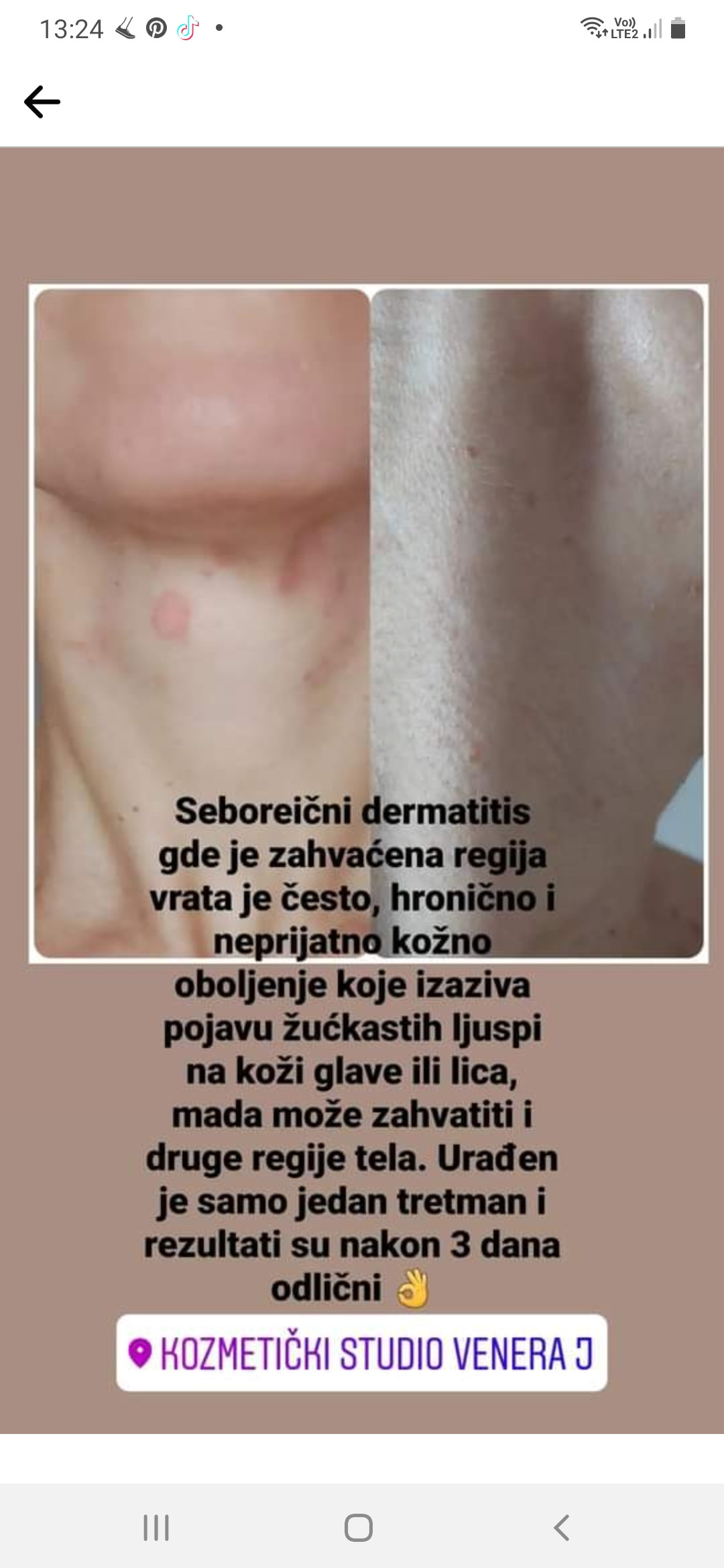 Elin Sary Mary Kutak #beograd Tretman lica Higijenski tretman lica + lifting