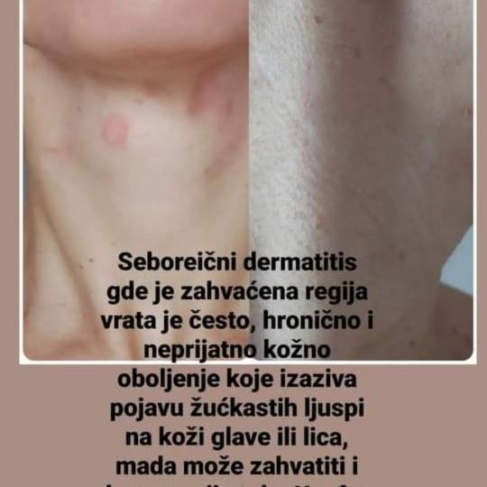 Elin Sary Mary Kutak #beograd Tretman lica Higijenski tretman lica + lifting