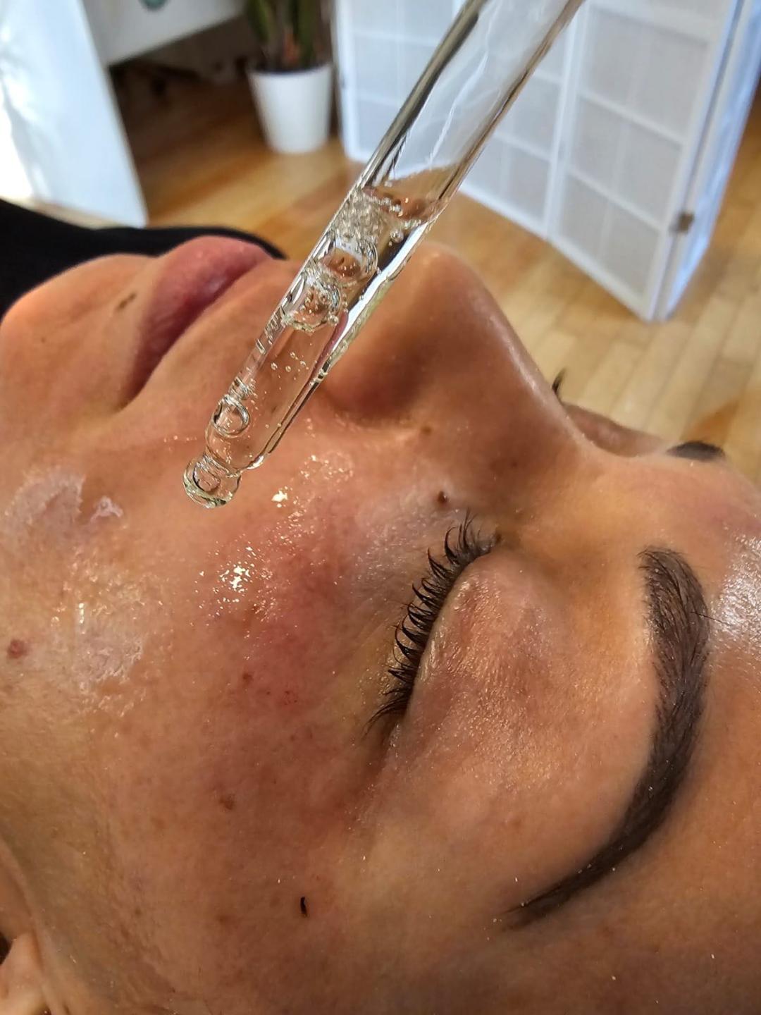 Esthetique Privé #beograd Tretman lica Higijenski tretman lica ( čišćenje lica) + dermapen