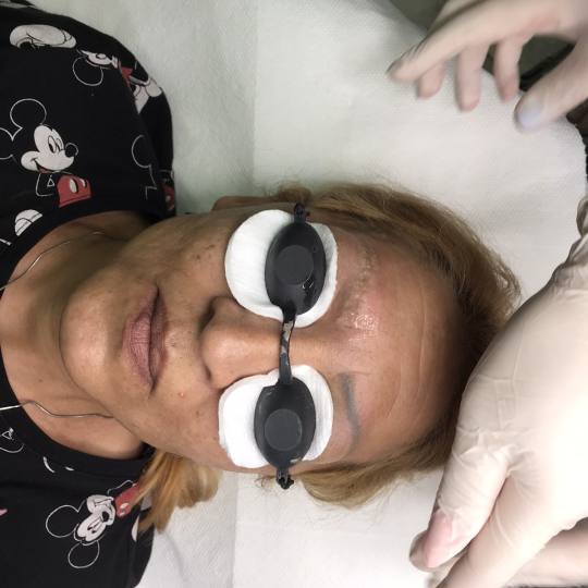Beauty Studio Asja 2 #novisad Trajna šminka Lasersko uklanjanje trajne šminke Lasersko uklanjane o