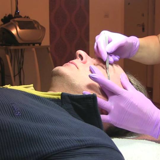 Mon cheri Anđela #beograd Dermaplaning-----Dermaplaning је metoda pilinga којa koristi  10 G s