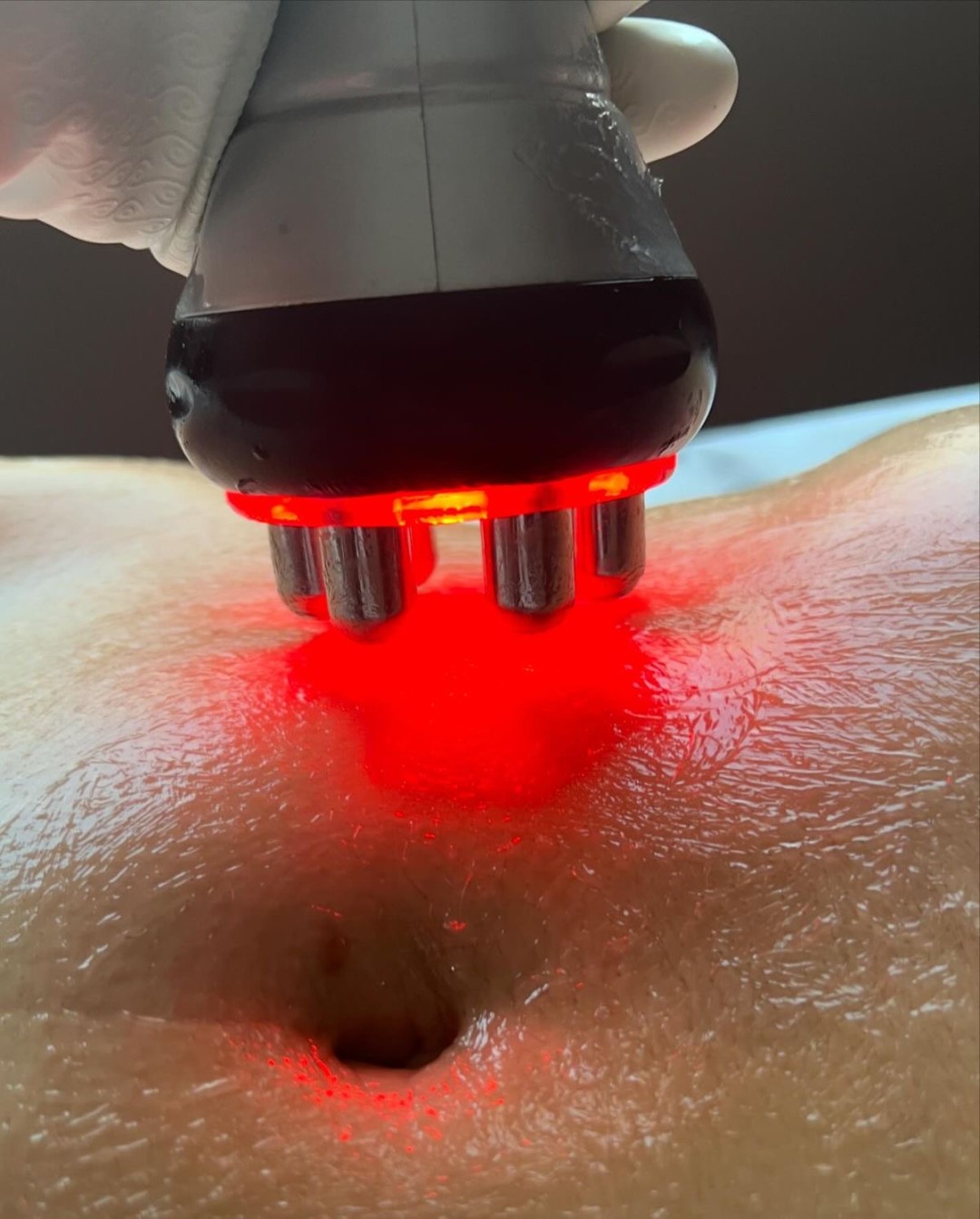 Studio lepote i edukativni centar Helios #kikinda Anticelulit masaža Kavitacija / RF po regiji - paket od 6 tretmana