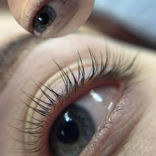 Diamond beauty #beograd