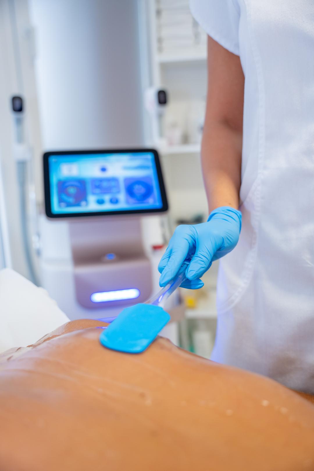 Laserska epilacija celih leđa - za muškarce - Monika Barta Cosmetics - Subotica, Subotica Laserska epilacija Depilacija Laserska epilacija, Subotica, Centar