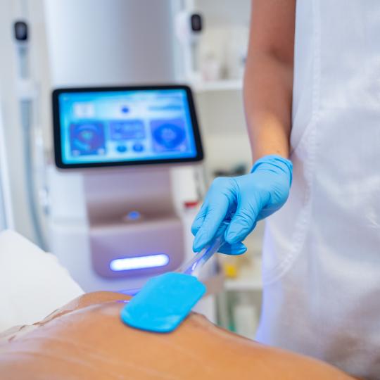 Monika Barta Cosmetics - Subotica #subotica Laserska epilacija Laserska epilacija celih leđa - za m