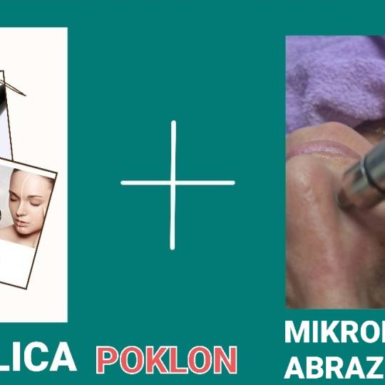 Laser centar Delight #beograd Laserski tretmani lica HIFU LICA PLUS POKLON MIKRODERMOABRAZIJA Hifu t