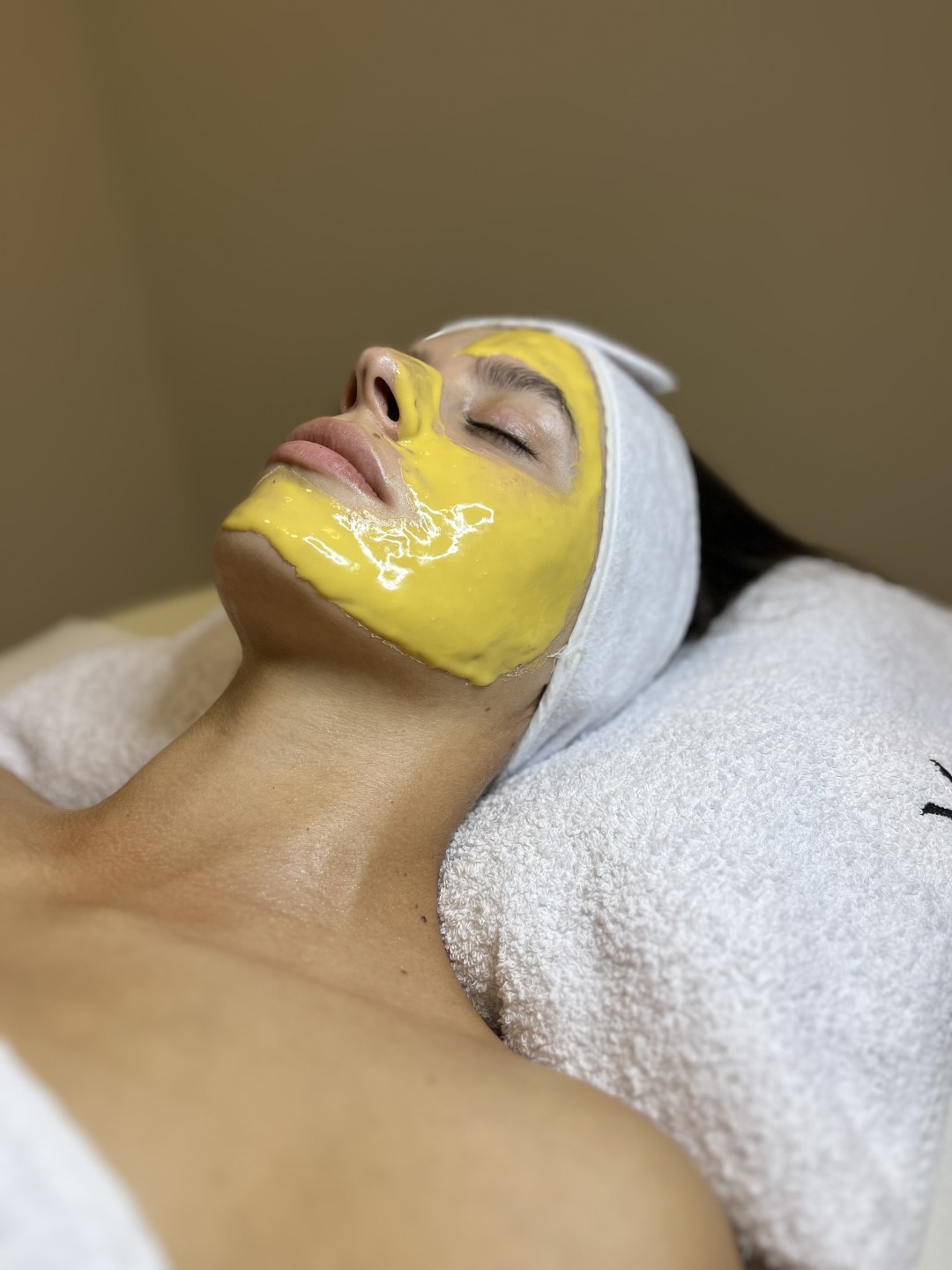 Laser centar Virgo #beograd Mezoterapija lica Higijenski tretman + papaya tretman