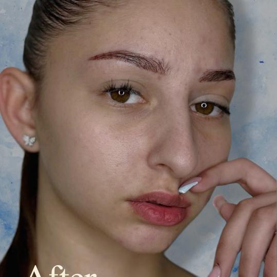 MiViDa Beauty System usluga