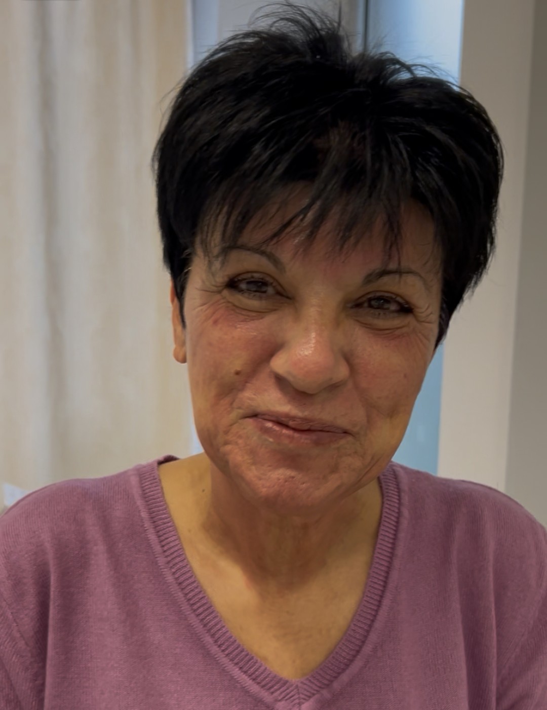 Sandra estetik studio #beograd Tretman lica Dermapen tretman lica