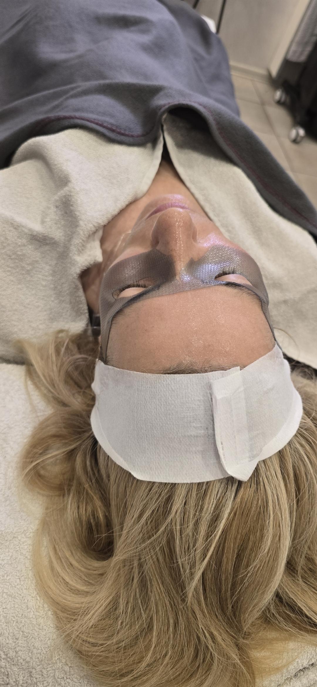 Dermapen + mezoterpija mikroiglicama - paket od tri tretmana - Laser lab by Ceca, Novi Sad Tretman lica Lice Tretman lica, Novi Sad, Grbavica, Liman, Adamićevo