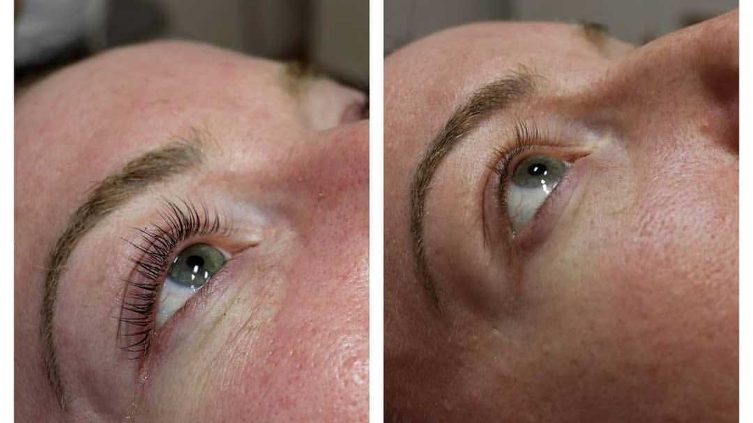 Lash lift + farbanje trepavica + botox - M Studio 0303, Novi Sad Trepavice Lice Trepavice, Novi Sad, Sajmište, Detelinara, Banatić
