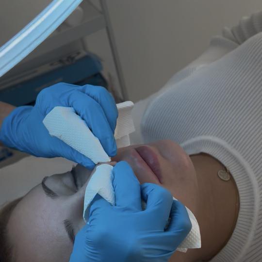 Sandra estetik studio #beograd Tretman lica Higijenski tretman lica Današnji higijenski tretman lic