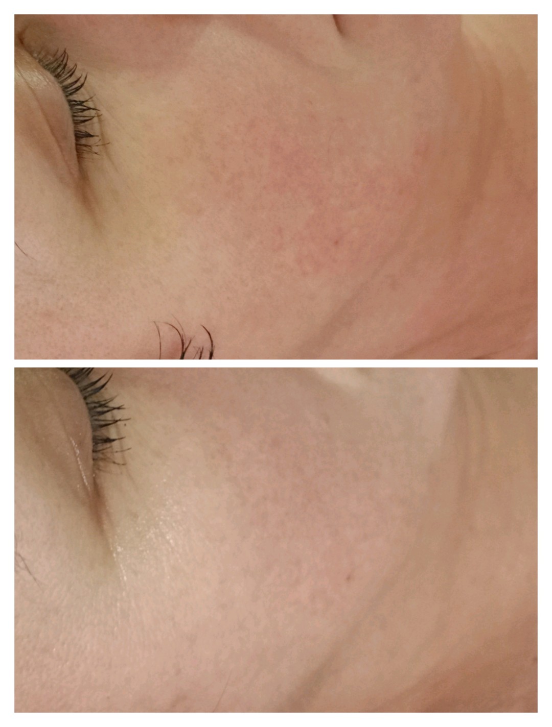 Bloom #sremska-mitrovica Tretman lica Happy skin (hidratacija i umirenje reaktivne i osetljive kože)