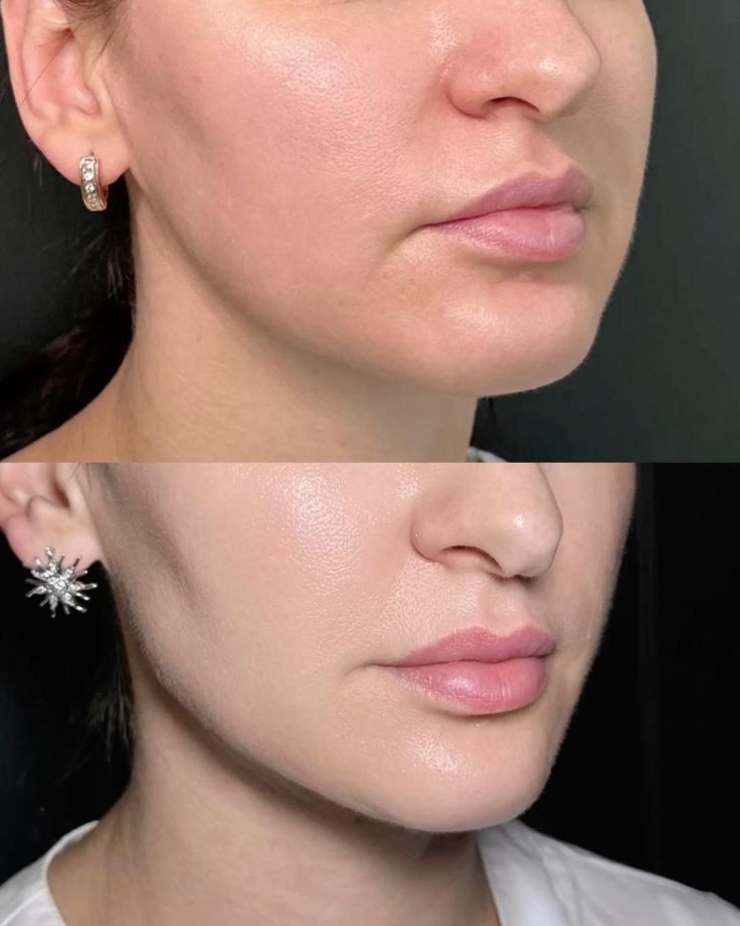 Elena Beauty, Kruševac LookBook