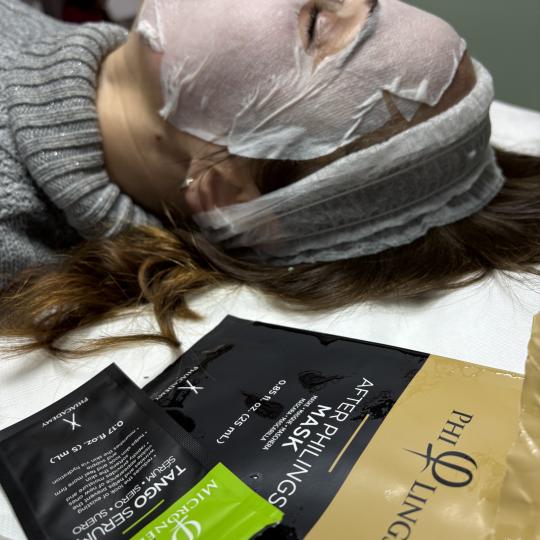 Beauty by Nevena Panić #beograd Dermaroler i dermapen Dermapen tretman