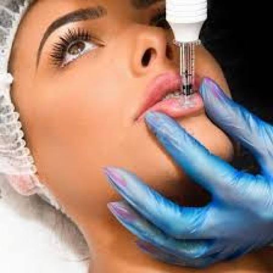 Vila Beauty Studio #beograd Tretman lica Hijaluron tretman lica Hijaluron pen je razvijen u Južnoj 