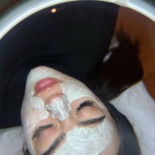 Esthetique Privé #beograd Tretman lica Higijenski tretman lica + dermapen
