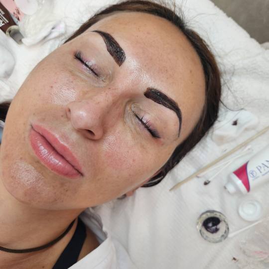 Starmedic #beograd Obrve Farbanje obrva
