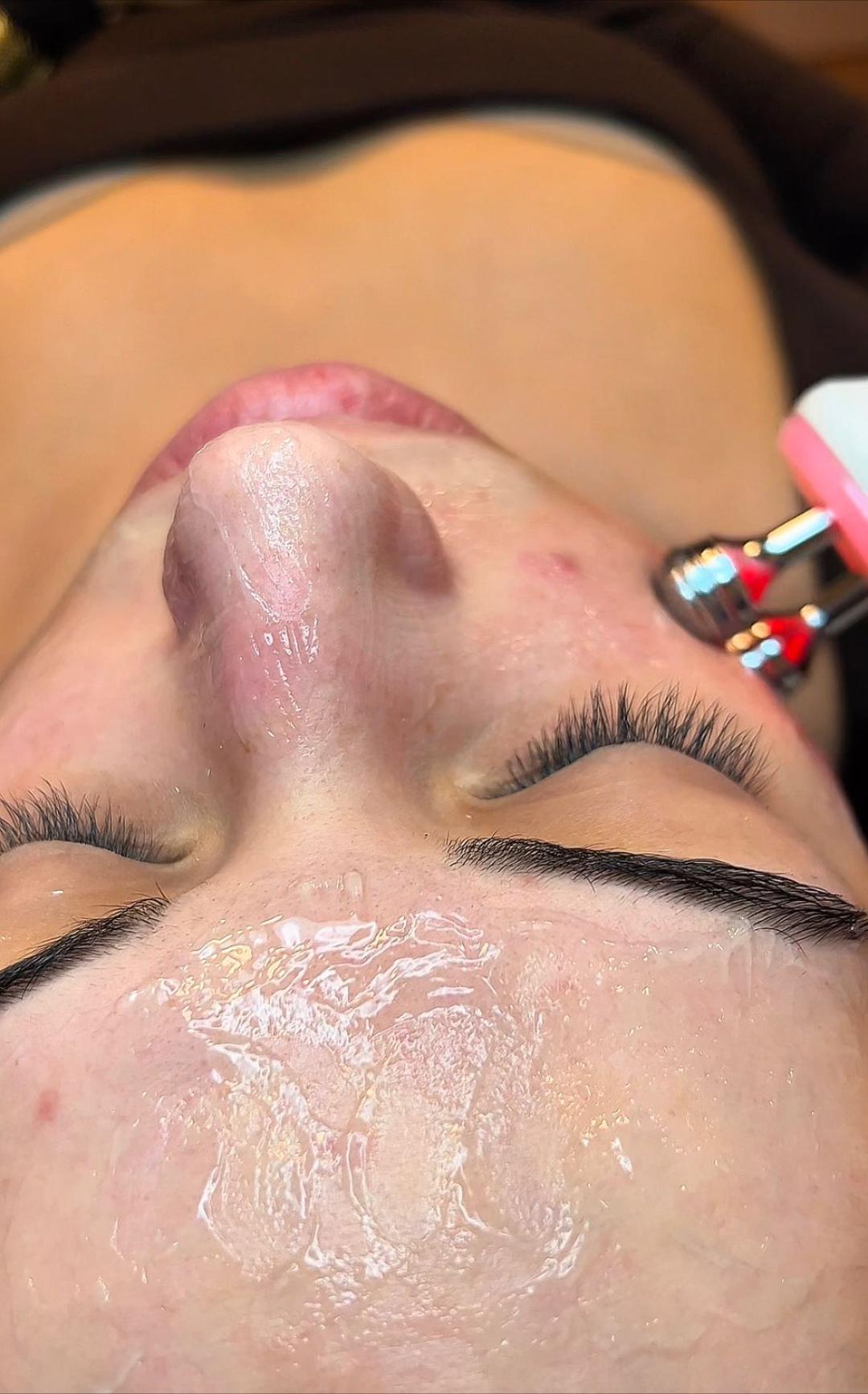 HydraGlow Facial - Hidrafacial tretman lica - Esthetique Privé, Beograd Tretman lica Lice Tretman lica, Beograd, Centar, Stari grad, Dorćol