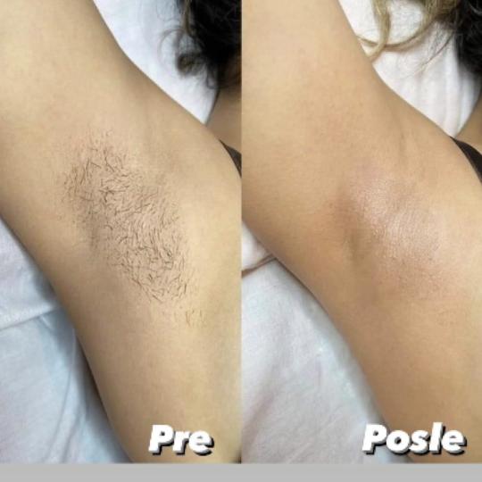Afro Spa usluga