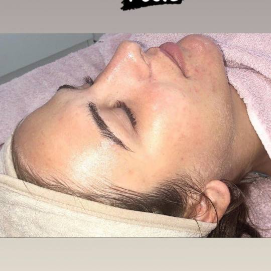 Makeup Olja Grbić #novisad Tretman lica Čišćenje lica ultrazvučnom špatulom lice  nakon čiš