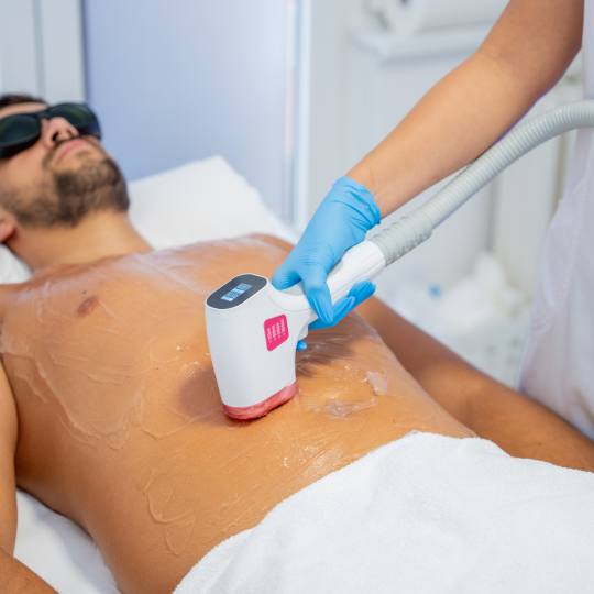 Monika Barta Cosmetics #novisad Laserska epilacija Laserska epilacija stomaka + grudi + leđa + pazu
