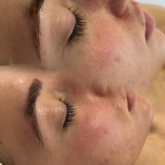 Bella Lunika Estetic studio #pancevo Tretman lica Higijenski tretman lica - lux hydra U nasem studiu