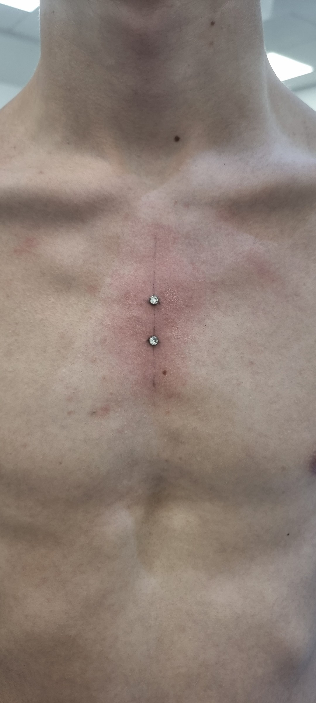 Bling Bling Piercing #beograd Tretmani tela Surface
