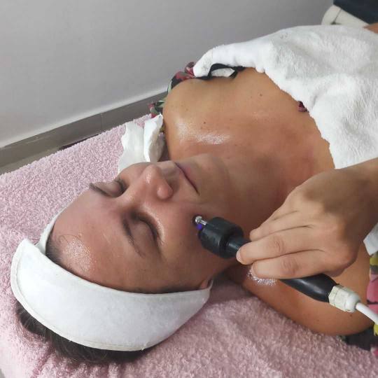 AngeLine #novisad Radiotalasni lifting