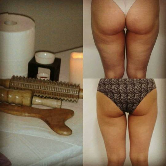 Be you 011 #beograd Opšta masaža anticelulit masaža