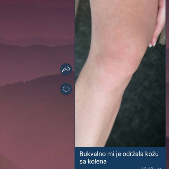 Sensus usluga