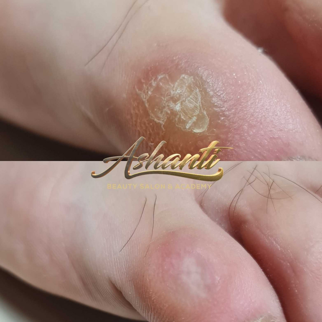 Ruski pedikir + lakiranje noktiju - Ashanti Beauty Salon & Academy, Beograd Estetski pedikir Nokti Estetski pedikir, Beograd, Voždovac