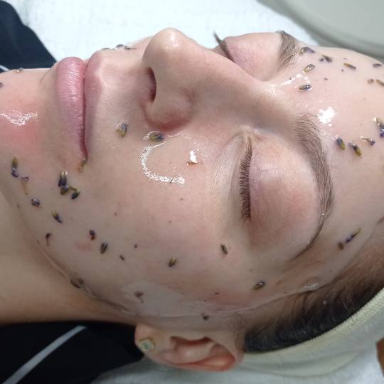 IQ aesthetic #beograd Tretman lica Hemijski piling lica Hemijski piling lica sa esthemax maskama koj