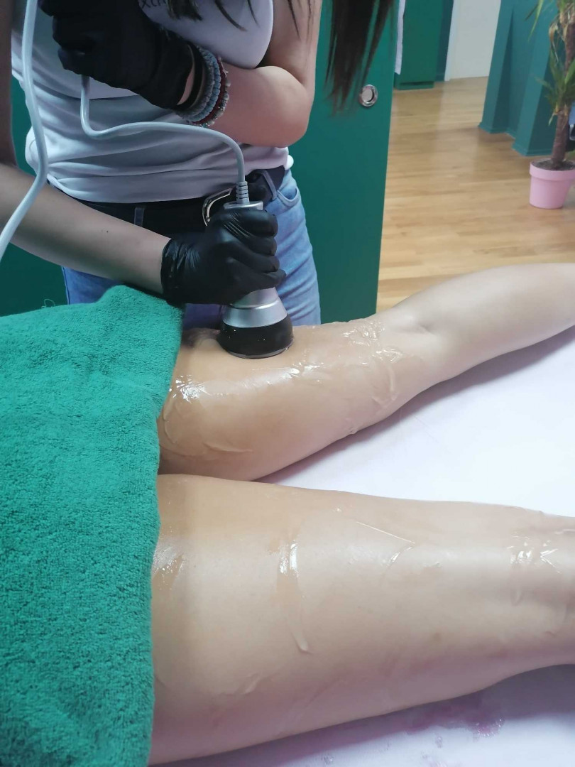 Butterfly Studio #beograd Kavitacija
