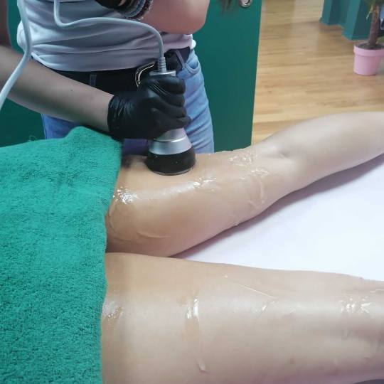 Butterfly Studio #beograd Kavitacija Ultrazvucna kavitacija Kavitacija + radiotalasni lifting - po r