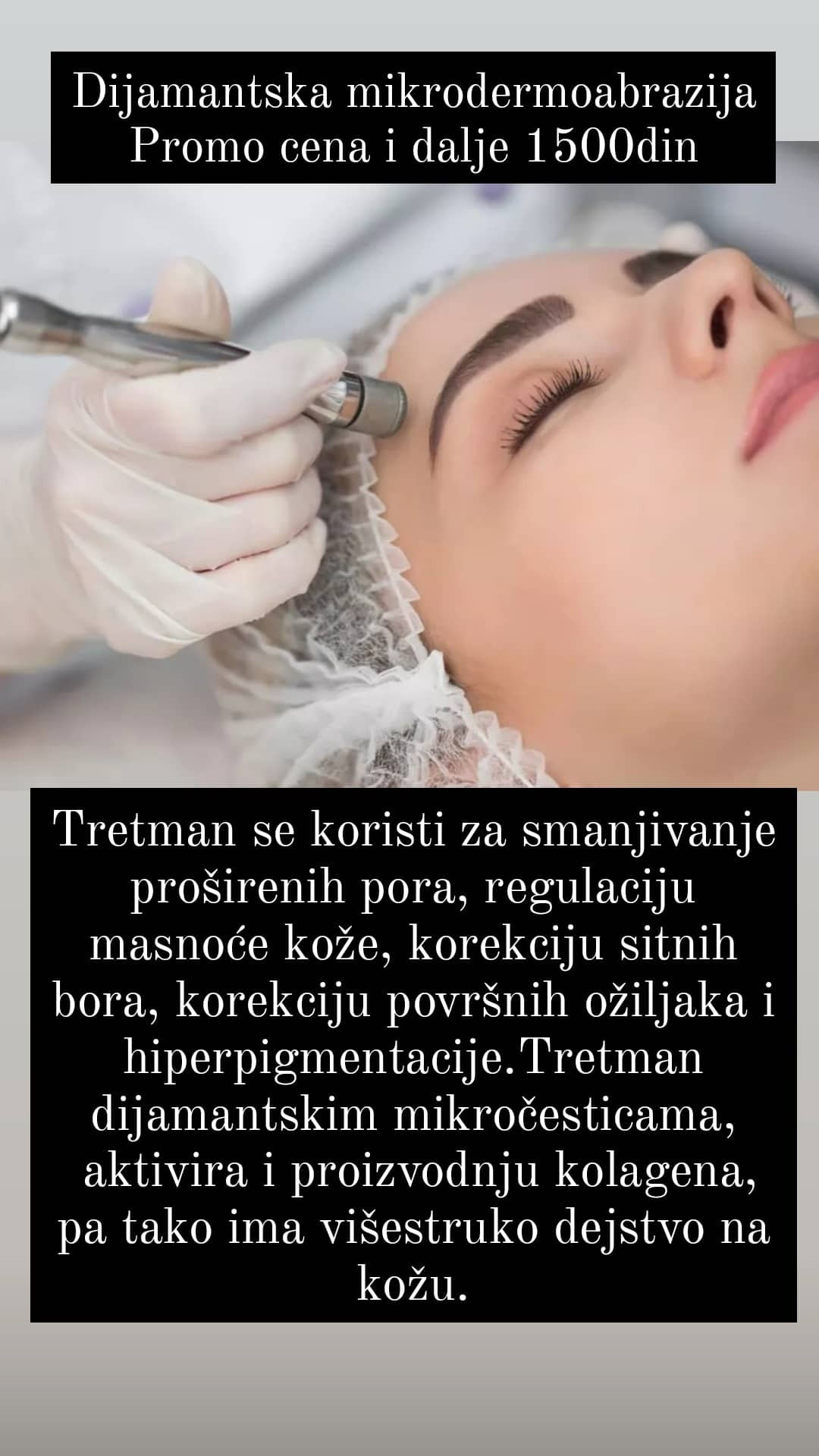 Salon Klinik #beograd Mikrodermoabrazija Mikrodermoabrzija