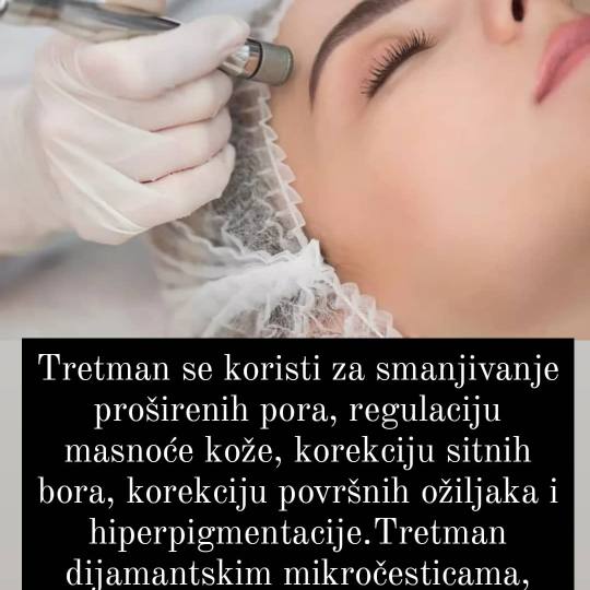 Salon Klinik #beograd Mikrodermoabrazija Mikrodermoabrzija