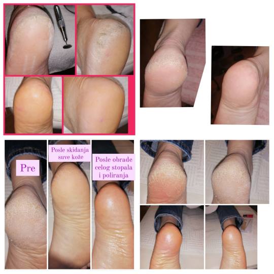 Mala Plava B #novisad Estetski pedikir Aparatni pedikir Aparatni pedikir sa profi diskom + gel lak