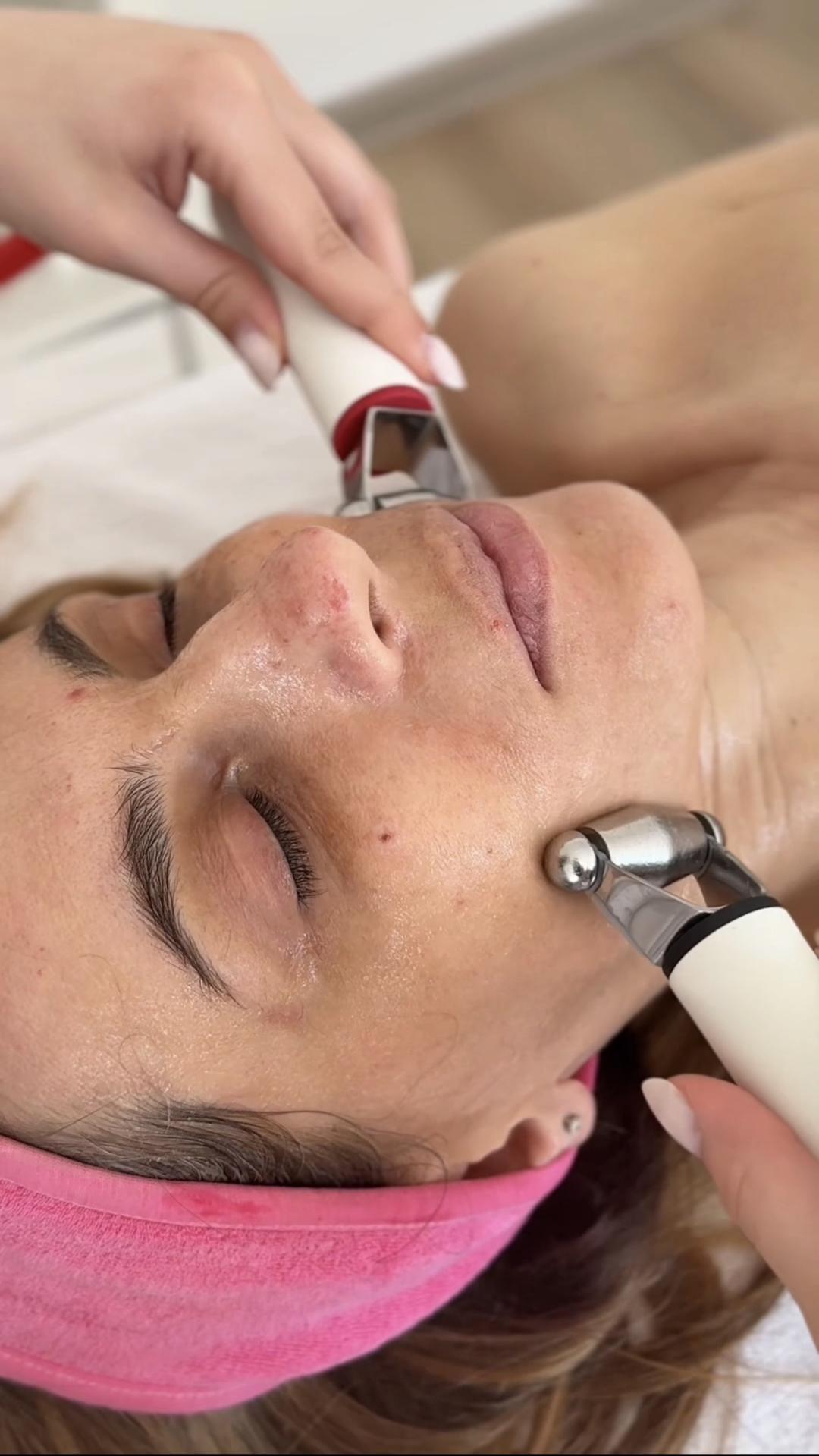 Hydradermie youth lift delux - premium aparatni tretman za lifting, podmlađivanje i hidrataciju - Lola esthetic center, Beograd Tretman lica Lice Tretman lica, Beograd, Novi Beograd blokovi, Belville, Savski kej