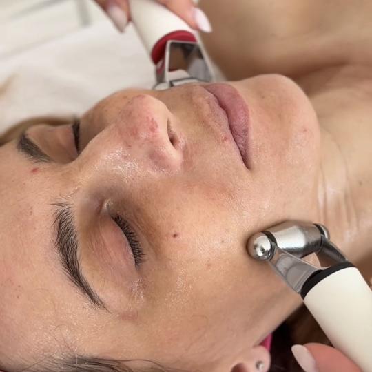 Lola esthetic center #beograd Tretman lica Hydradermie youth lift delux - premium aparatni tretman z