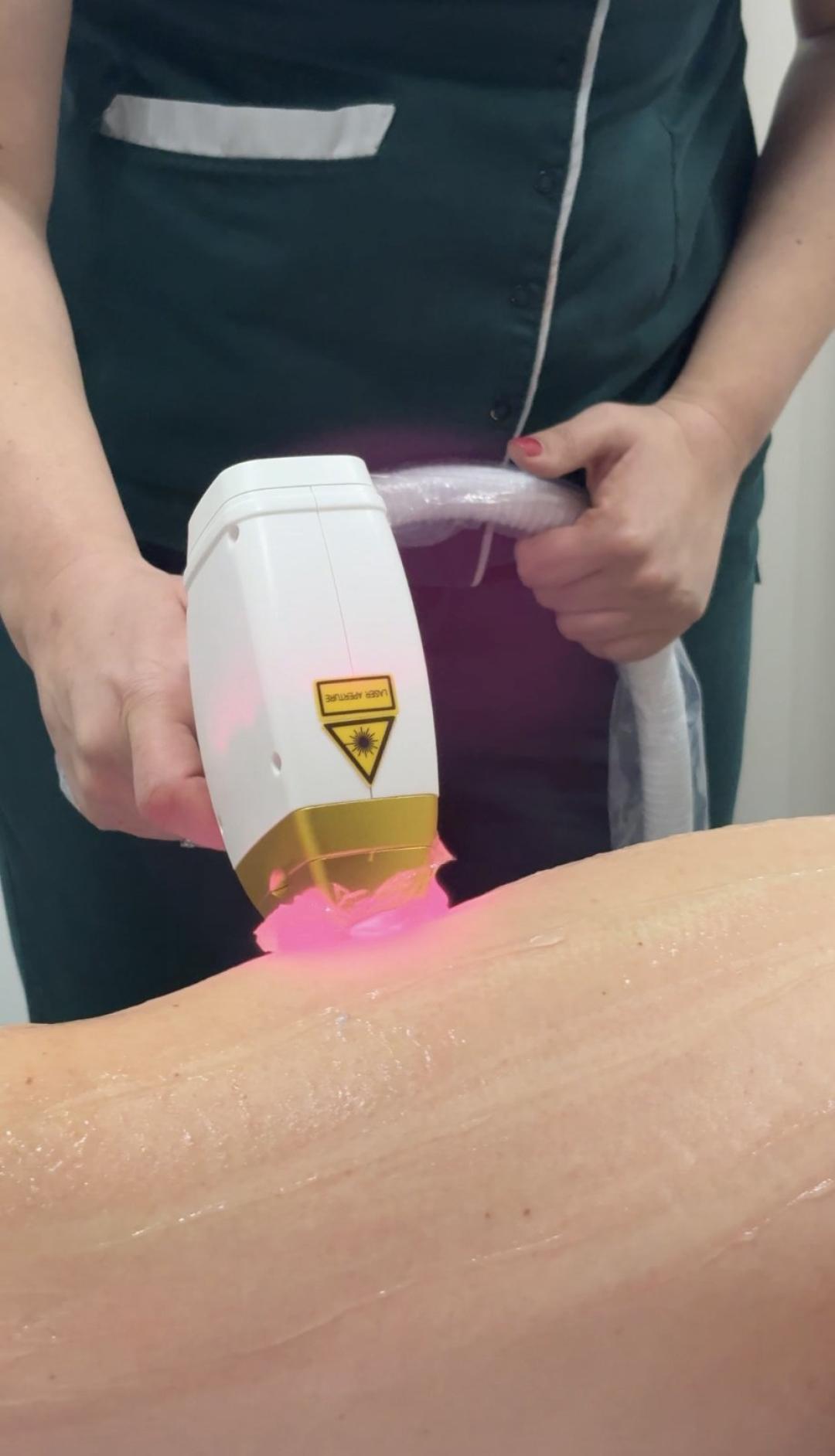 Estetik MPL 87 #beograd