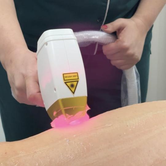 Estetik MPL 87 #beograd