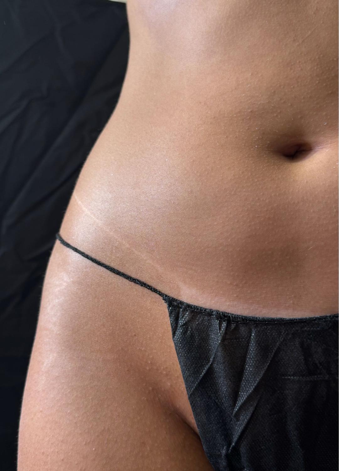 Vanilla Beauty Concept #beograd Air brush potamnjivanje kože Spray tan - celo telo