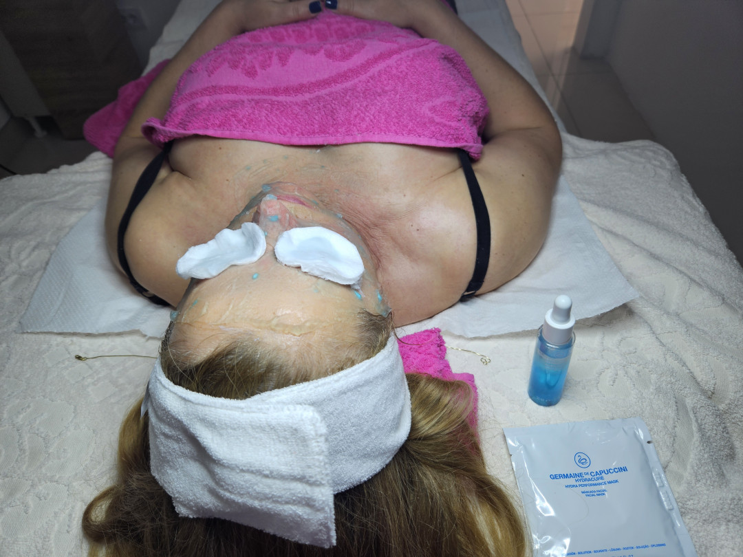 Ogledalce Starmedic #beograd Tretman lica Hidratacija preparatima